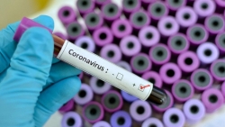 Число инфицированных коронавирусом в Челябинской области перевалило за три сотни